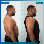 SlimForm Pro™ – Faja de Compresión y Moldeado Masculino de Alta Tecnología